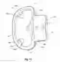 Fig. 17 - Milling system with guide paths and related methods for resecting a joint articulation surface