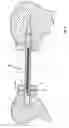 Fig. 04 - Device for lengthening bones or bone parts