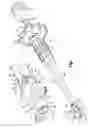 Fig. 02 - Surgical instrument for moving vertebrae