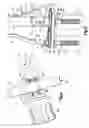 Fig. 04 - Surgical instrument for moving vertebrae