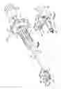 Fig. 05 - Surgical instrument for moving vertebrae