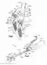 Fig. 06 - Surgical instrument for moving vertebrae