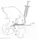 Fig. 01 - Segmented joint distractor