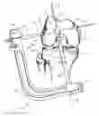 Fig. 01 - Graft fixation device and method