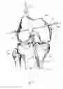 Fig. 14 - Graft fixation device and method