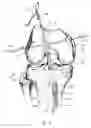 Fig. 16 - Graft fixation device and method