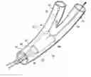Fig. 01 - BIFURCATED STENT DELIVERY SYSTEM AND METHOD OF USE