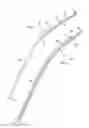 Fig. 02 - BIFURCATED STENT DELIVERY SYSTEM AND METHOD OF USE