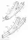 Fig. 04 - BIFURCATED STENT DELIVERY SYSTEM AND METHOD OF USE