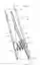 Fig. 41 - Retrieval catheter