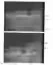 Fig. 43 - Retrieval catheter