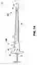 Fig. 02 - Low profile suturing instrument