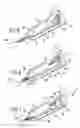 Fig. 06 - Suture trimmer