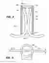 Fig. 04 - Self-closing surgical clip for tissue