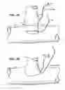 Fig. 07 - Self-closing surgical clip for tissue
