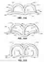Fig. 12 - Self-closing surgical clip for tissue