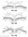 Fig. 13 - Self-closing surgical clip for tissue