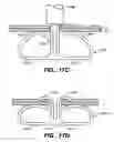 Fig. 16 - Self-closing surgical clip for tissue