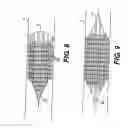 Fig. 05 - Embolic protection device