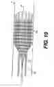 Fig. 06 - Embolic protection device