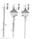 Fig. 08 - Embolic protection device