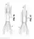 Fig. 09 - Embolic protection device