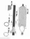 Fig. 11 - Embolic protection device
