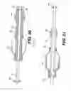 Fig. 13 - Embolic protection device