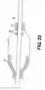 Fig. 14 - Embolic protection device