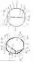 Fig. 04 - Embolic protection device