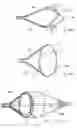Fig. 06 - Embolic protection device