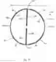 Fig. 10 - Embolic protection device