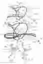 Fig. 11 - Embolic protection device