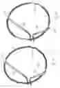 Fig. 14 - Embolic protection device