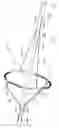 Fig. 26 - Embolic protection device