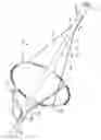 Fig. 27 - Embolic protection device