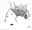 Fig. 02 - Endovascular device for entrapment of participate matter and method for use