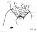 Fig. 03 - Endovascular device for entrapment of participate matter and method for use