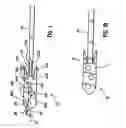 Fig. 02 - Knotless suture lock and bone anchor implant method