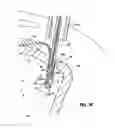 Fig. 07 - Knotless suture lock and bone anchor implant method
