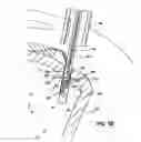 Fig. 08 - Knotless suture lock and bone anchor implant method