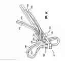 Fig. 16 - Knotless suture lock and bone anchor implant method