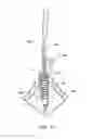 Fig. 25 - Knotless suture lock and bone anchor implant method