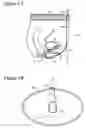 Fig. 02 - Non-invasive modulation of the autonomic nervous system