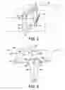 Fig. 03 - Device and method for low intensity optical hair growth control