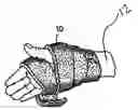 Fig. 01 - Compression bandage
