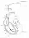 Fig. 01 - Multiple electrode implantable lead