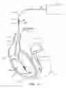Fig. 02 - Multiple electrode implantable lead