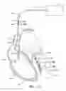 Fig. 03 - Multiple electrode implantable lead