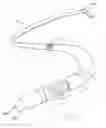 Fig. 04 - Multiple electrode implantable lead